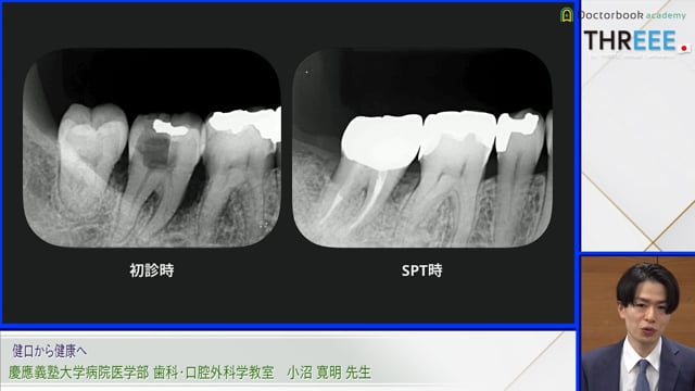 健口から健康へ│小沼 寛明先生