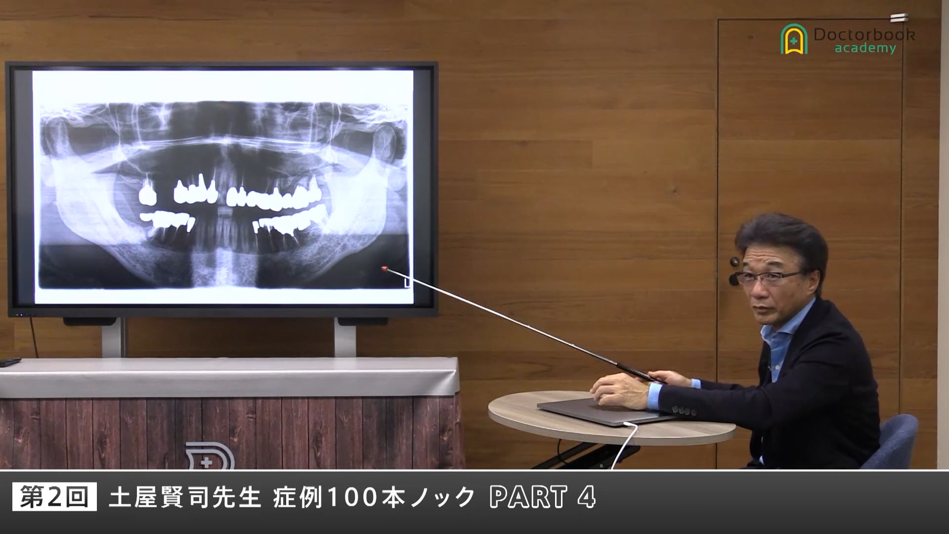全顎補綴と骨格Ⅲ級症例に学ぶ―補綴設計とトラブル回避のディスカッション #4
