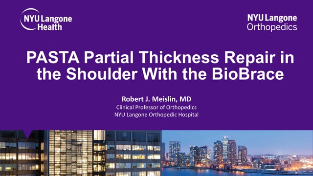 PASTA Partial Thickness Repair in the Shoulder With the BioBrace