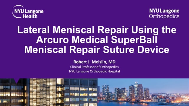 Lateral Meniscal Repair Using the Arcuro Medical SuperBall Meniscal Repair Suture Device