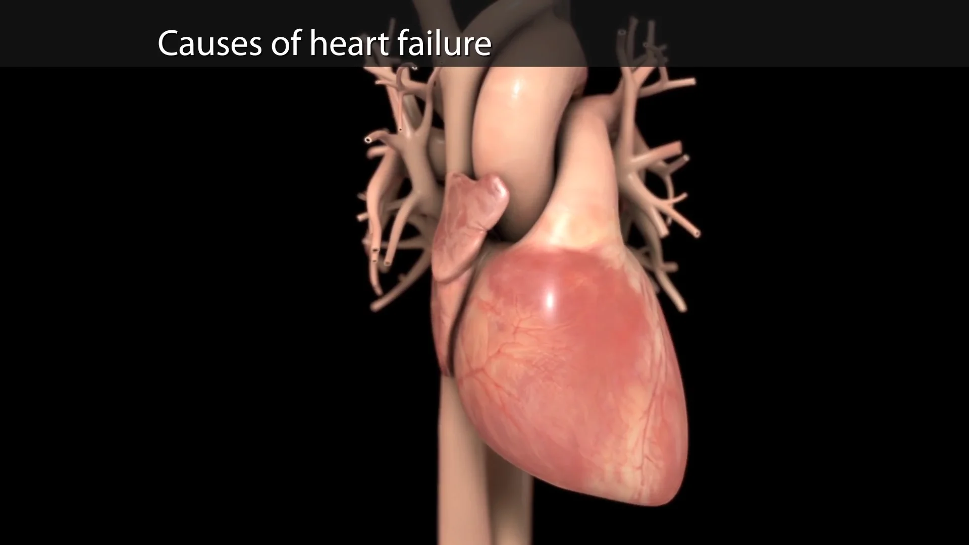 Heart Failure - Causes and Risk Factors | NHLBI, NIH