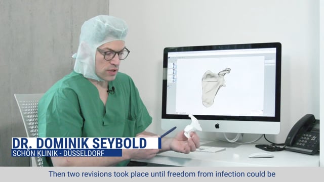 Prof. Dr. med. Dominik Seybold’s experience with NextAR Shoulder