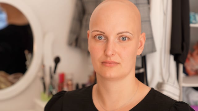 Alopezie: Leben ohne Haare