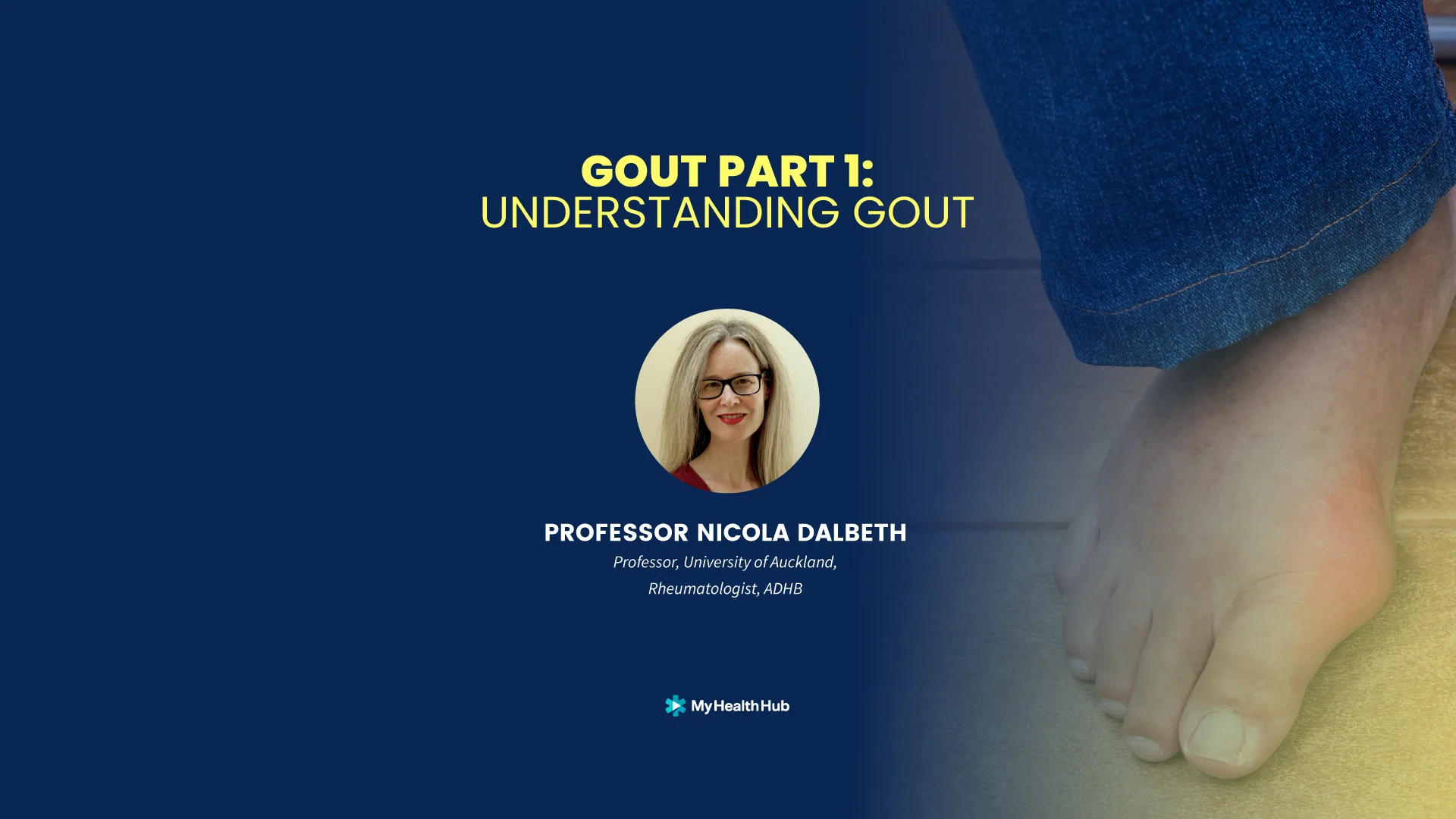 Understanding Gout : Part 1
