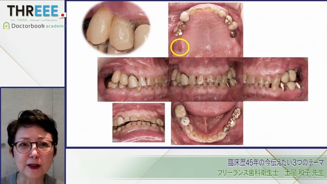 臨床歴45年の今伝えたい3つのテーマ│土屋 和子先生
