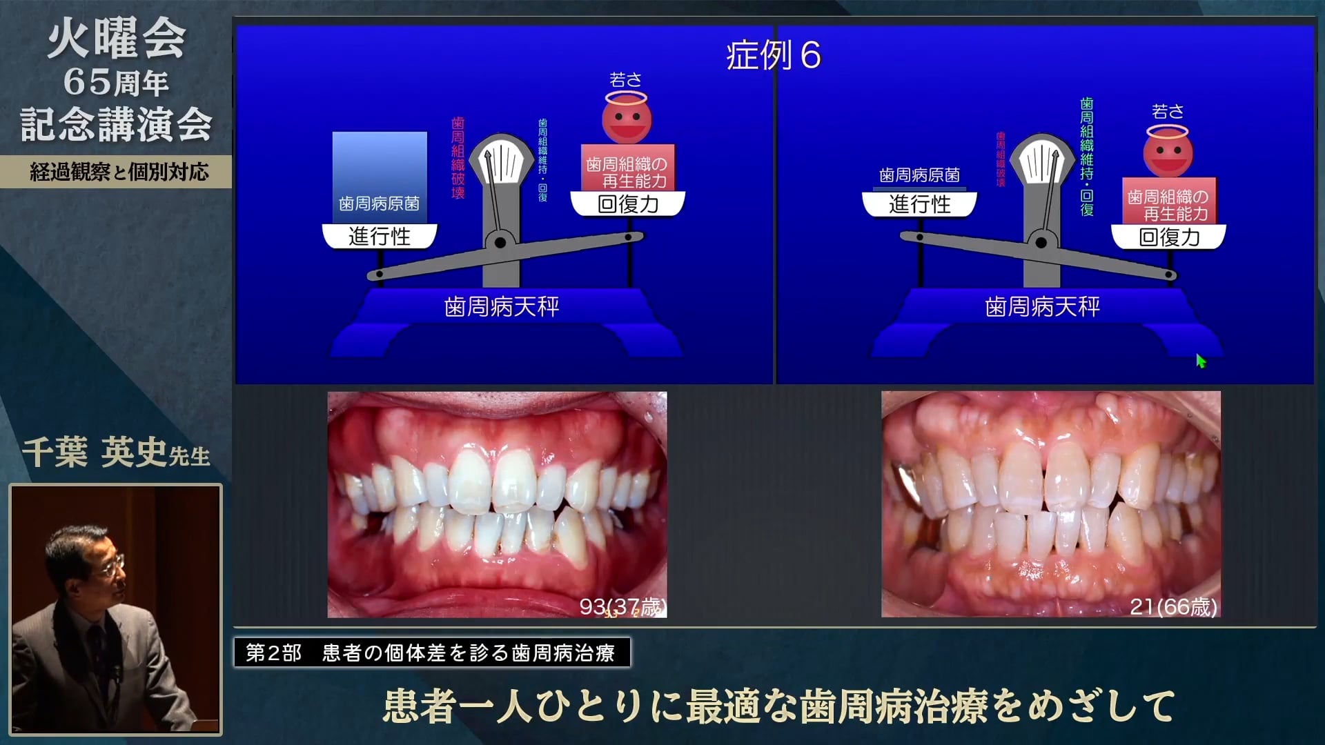 患者一人ひとりに最適な歯周治療をめざして│千葉 英史先生