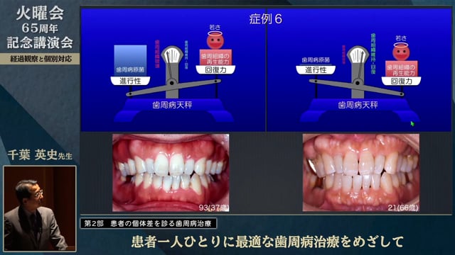 患者一人ひとりに最適な歯周治療をめざして│千葉 英史先生