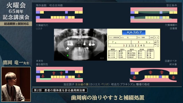 歯周病の治りやすさと補綴処置│鷹岡 竜一先生