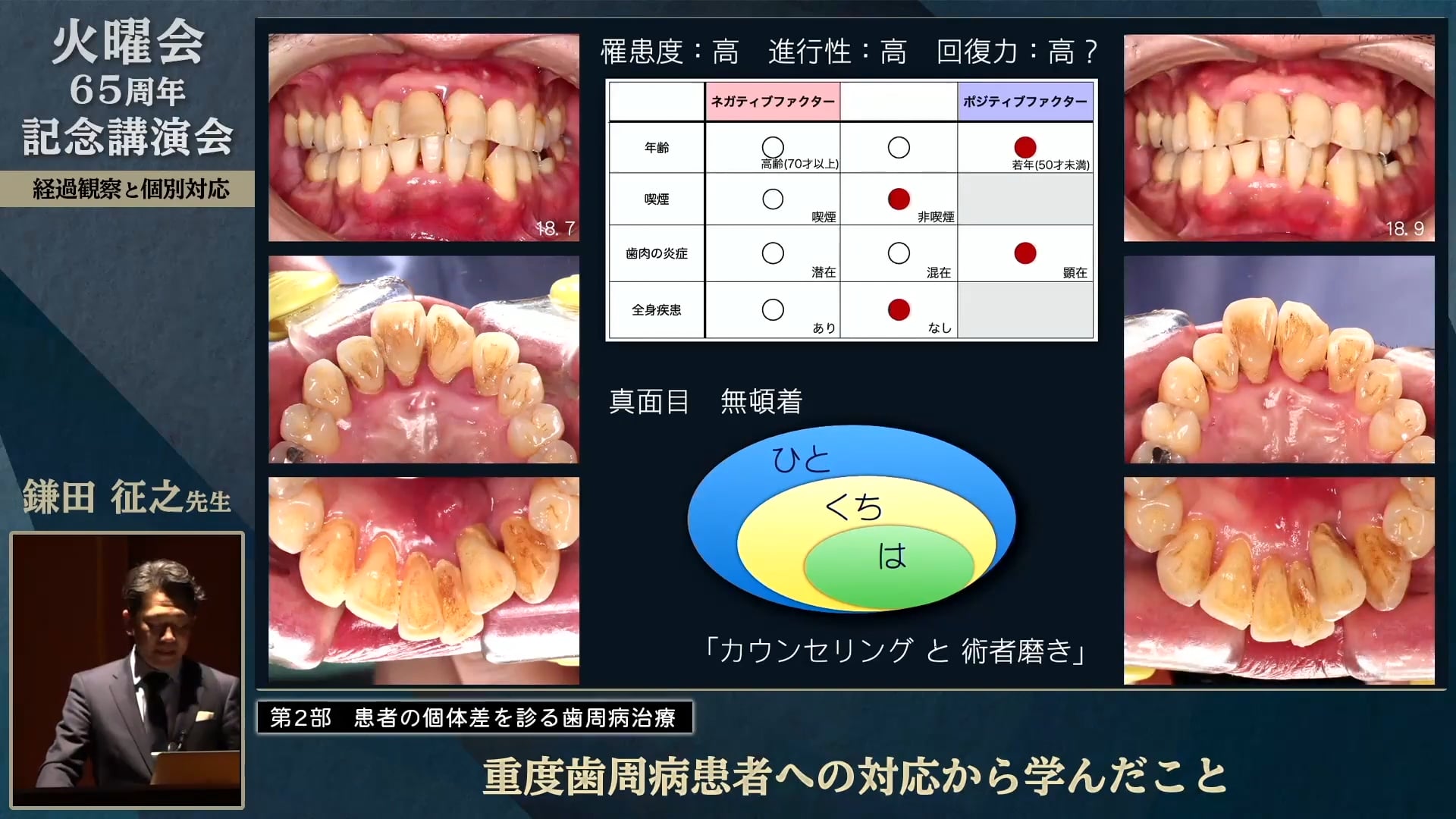 重度歯周病患者への対応から学んだこと│鎌田 征之先生