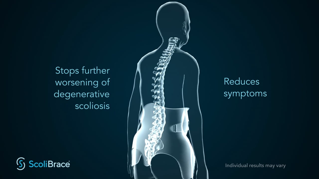 ScoliBrace - The World's Most Advanced Scoliosis Brace