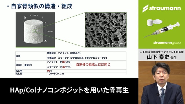 骨補填剤の基礎と説明