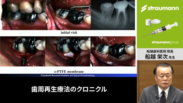 専門店では Dr.Hiroの実践!歯周治療 インスツルメンテーションマスター 