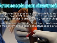 Procedimiento mínimamente invasivo para Rizartrosis usando #artroscopia