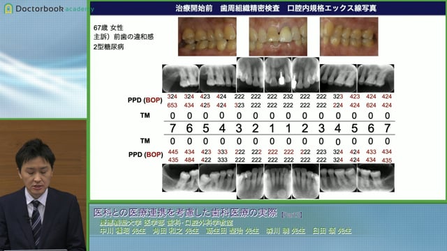 医科との医療連携を考慮した歯科医療の実際│森川 暁先生