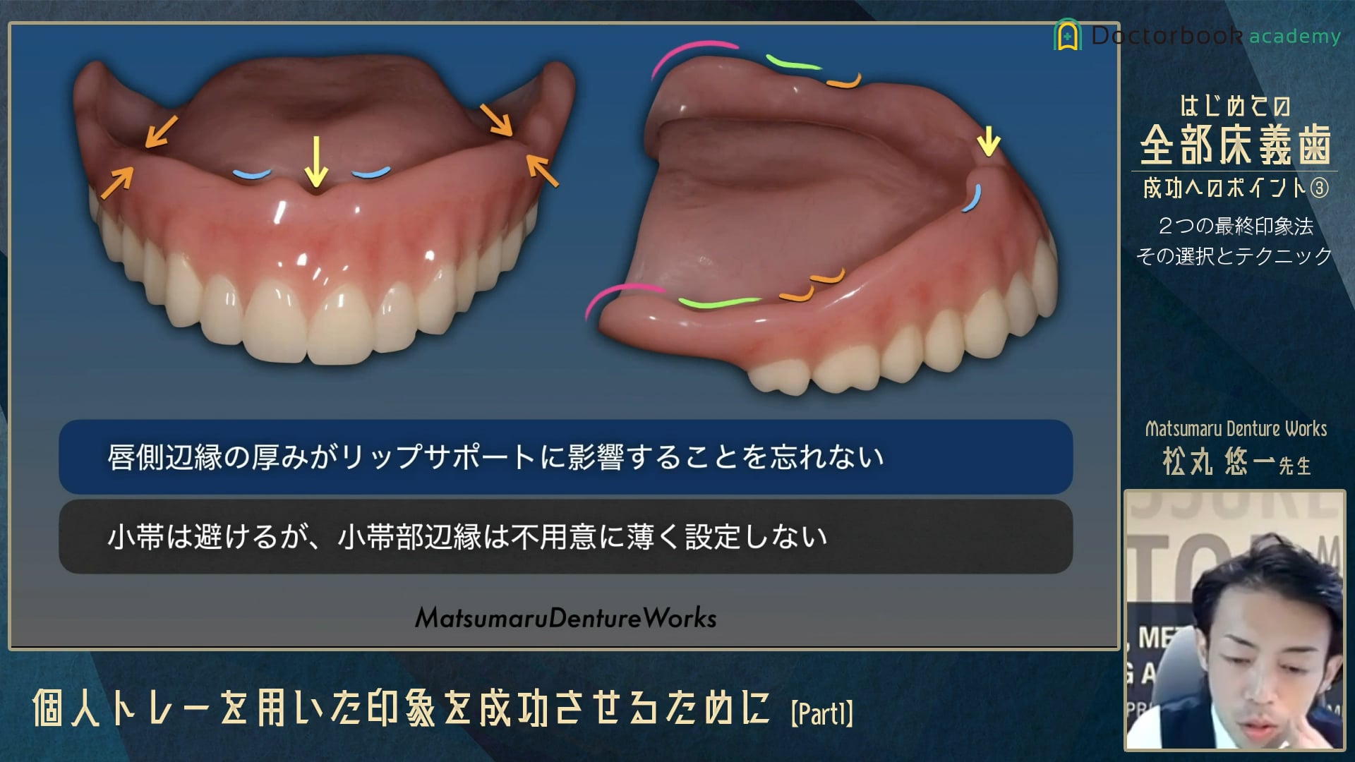 個人トレーを用いた印象を成功させるために Part1