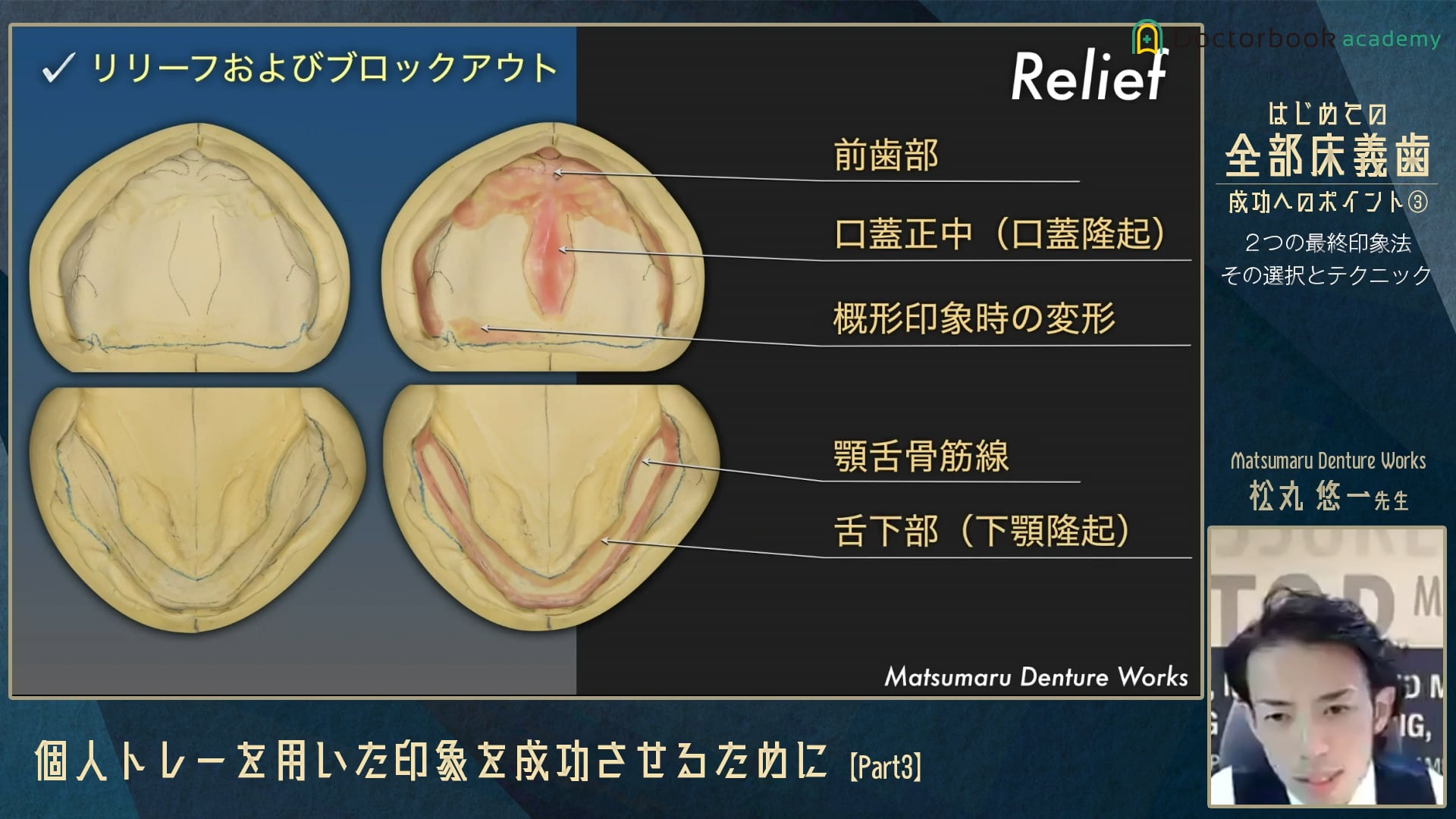 個人トレーを用いた印象を成功させるために Part3