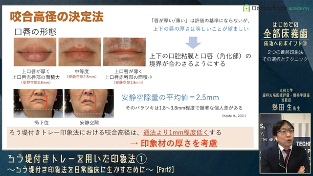 ろう堤付きトレーを用いた印象法① Part2