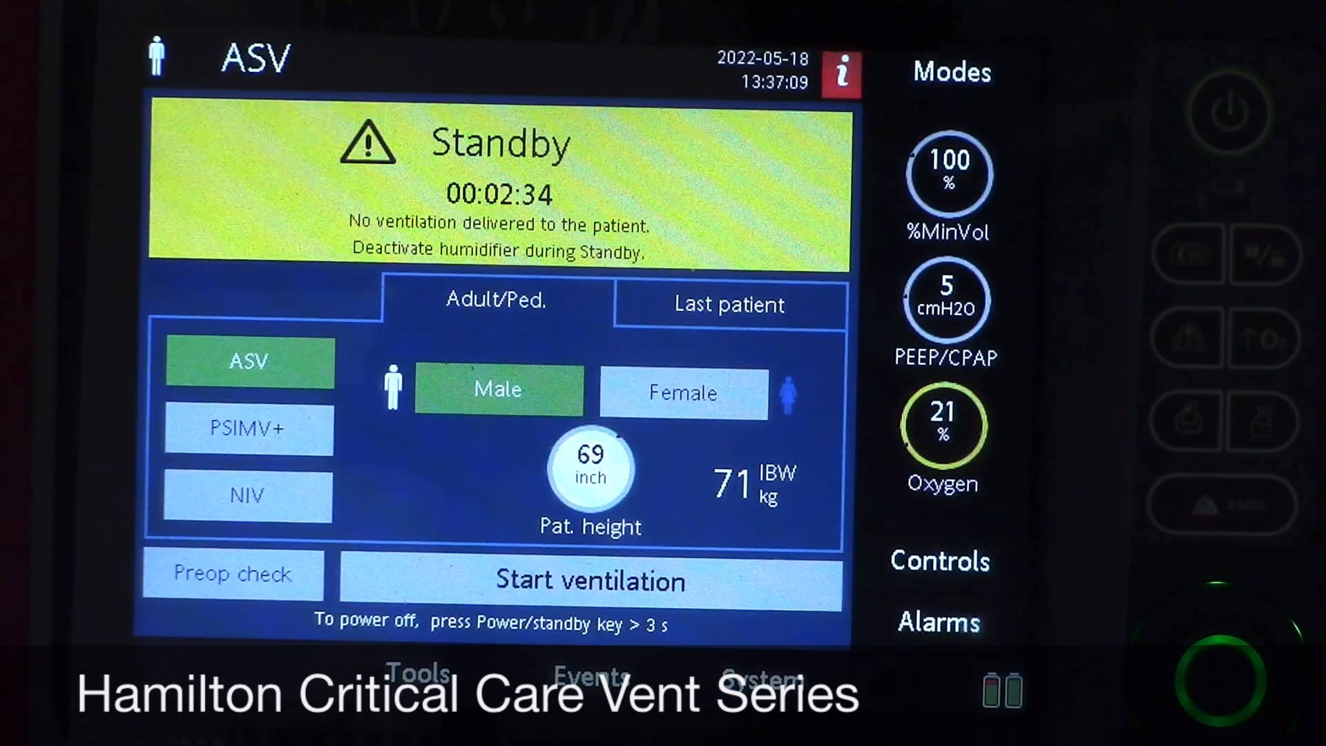 What does Minute Volume mean? Switching to ASV on a Patient doing well