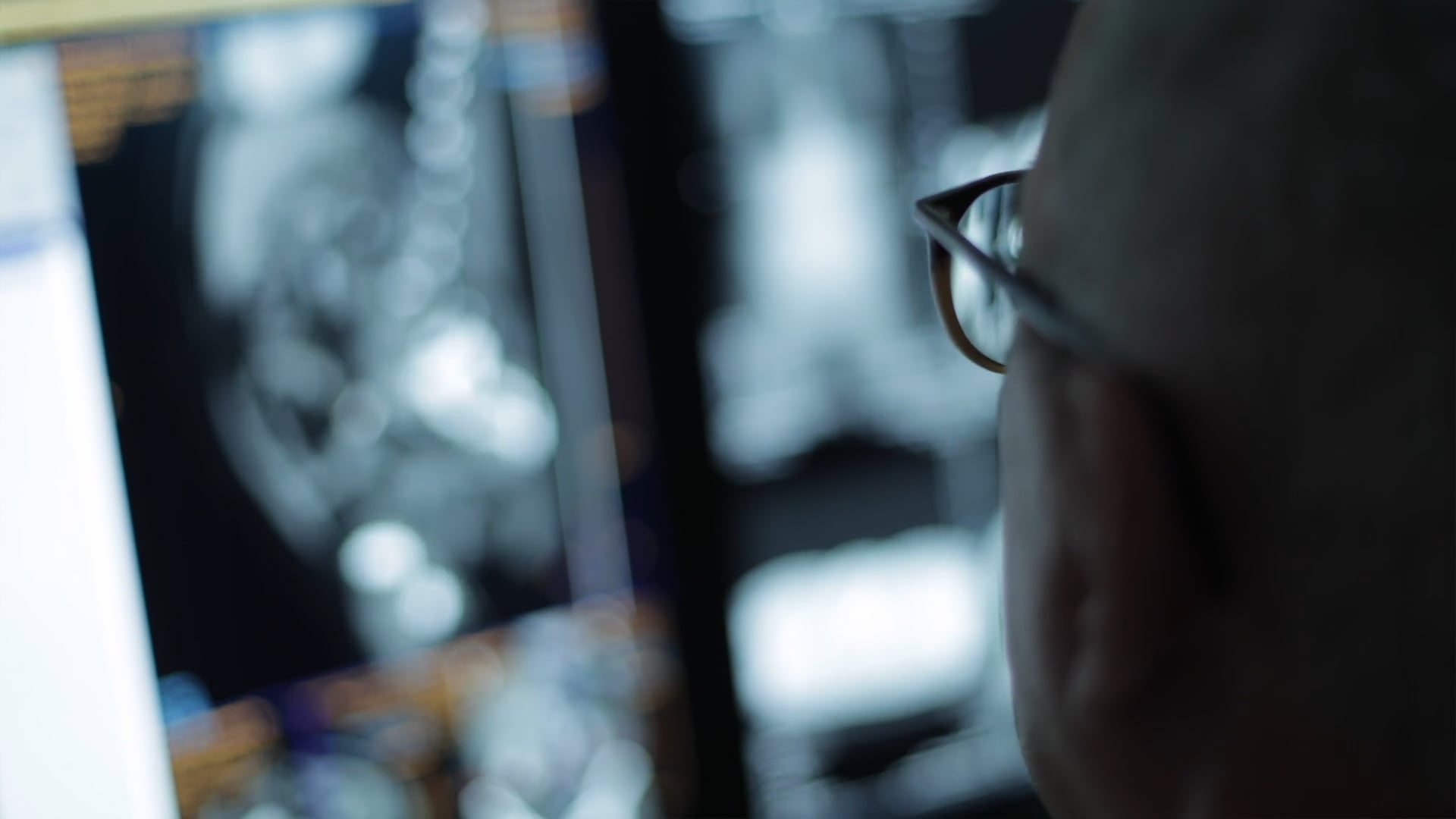 Recruitingfilm - Radiologie Bremen
