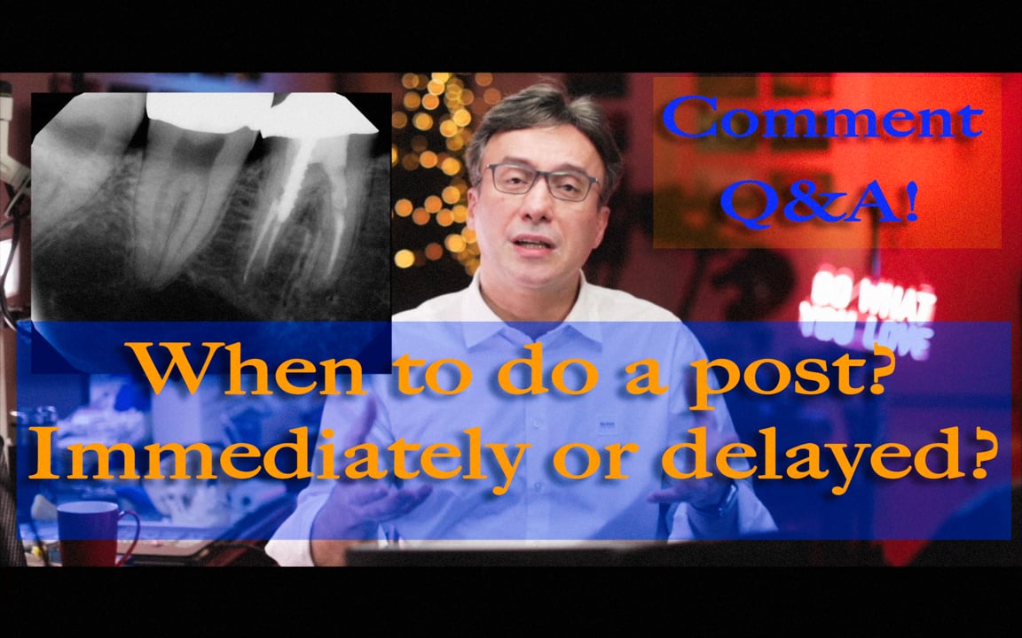 Should you place a post immediately or wait after obturation?