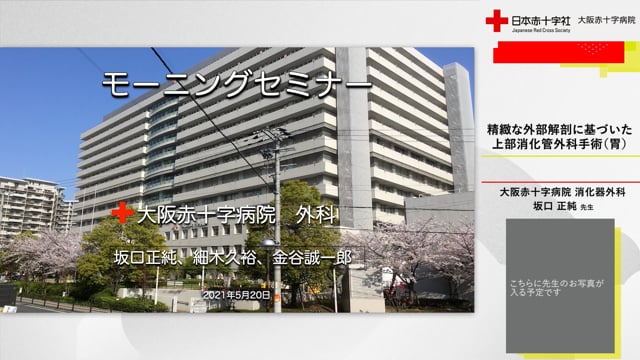 精密な外科解剖に基づいた上部消化管外科手術（胃） | Clinical
