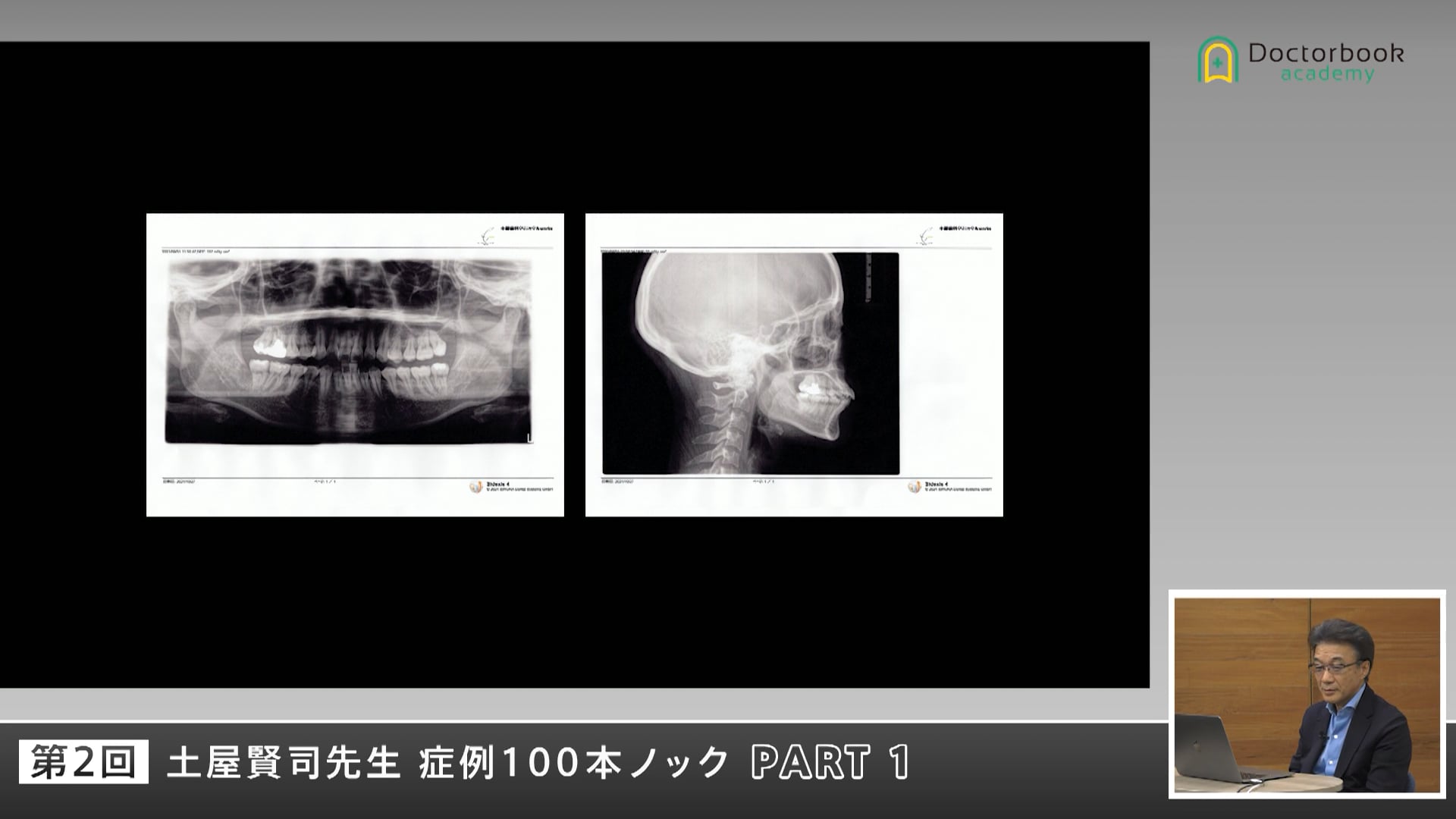 患者の20年後を見据えた治療計画―信頼を築く説明とチームワーク #1