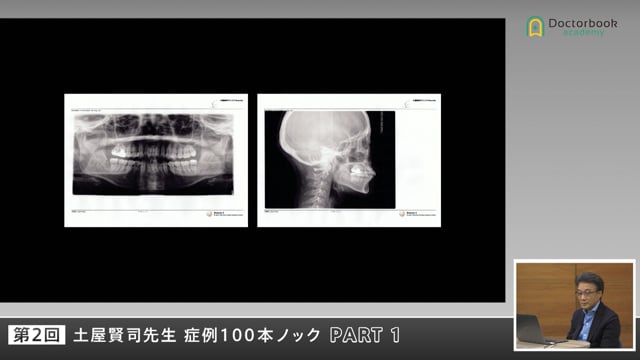 患者の20年後を見据えた治療計画―信頼を築く説明とチームワーク #1