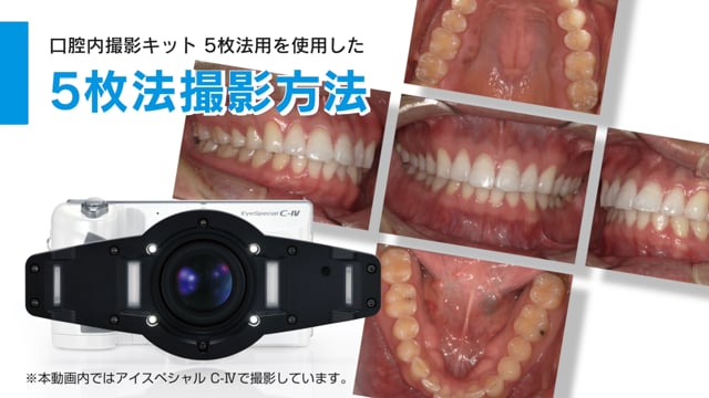 【口腔内撮影キット】を使用した5枚法撮影方法