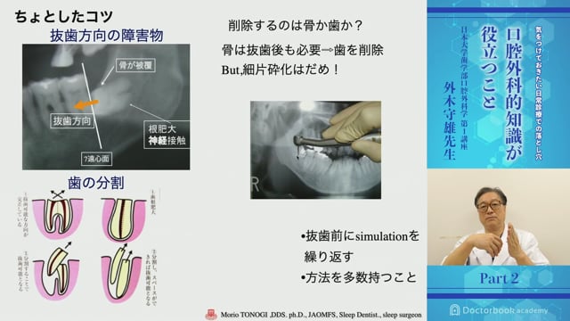 DVD/医学的・口腔外科的側面からみたインプラント外科の真髄