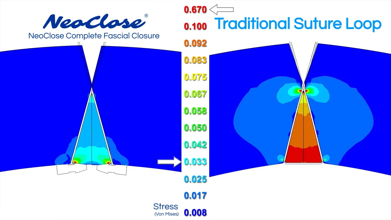 neoClose® product animation v5 (2) on Vimeo