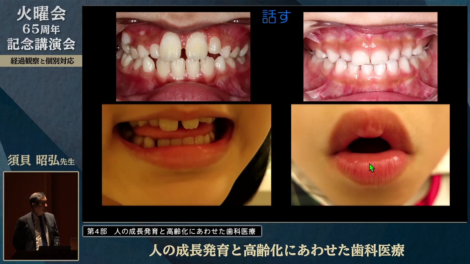 人の成長発育と高齢化にあわせた歯科医療│須貝 昭弘先生