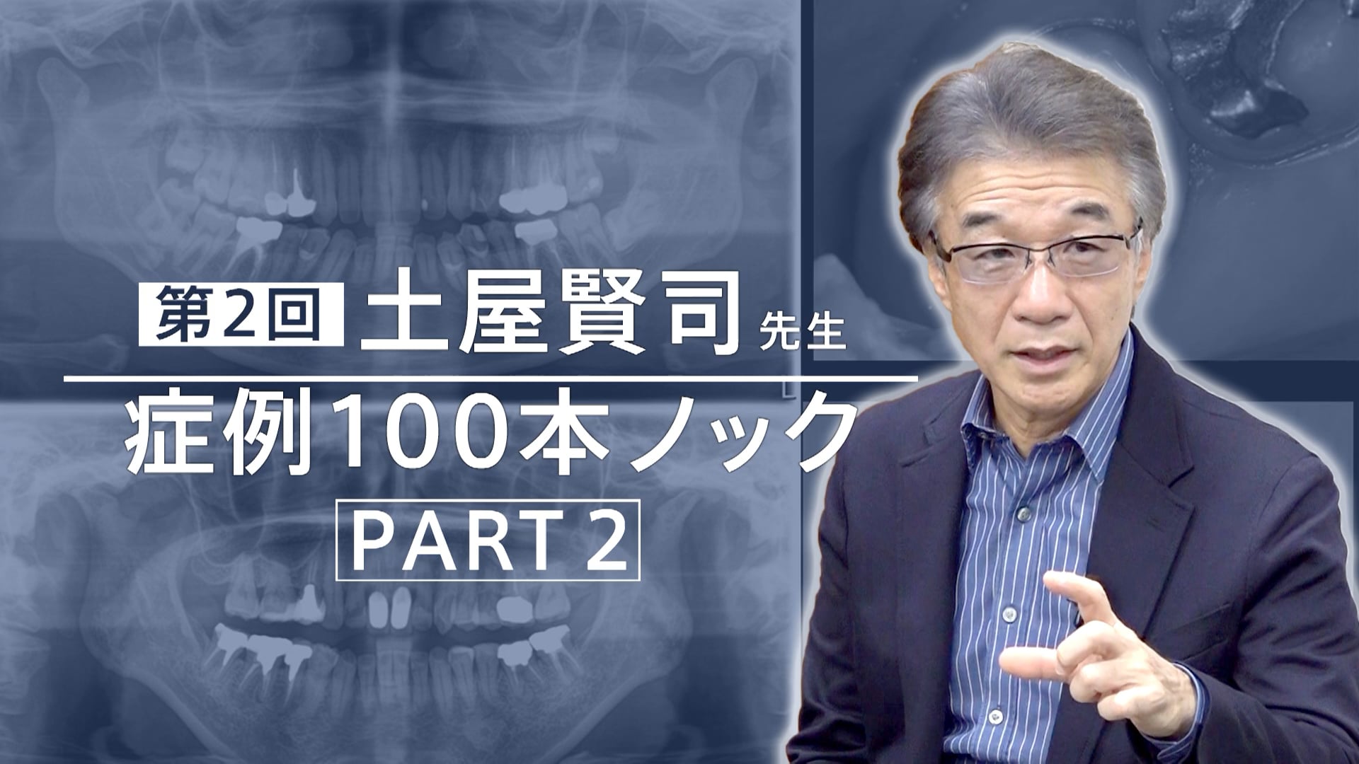 土屋賢司先生 症例100本ノック 第2回 PART2