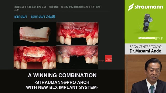 A WINNING COMBINATION -STRAUMANN®PRO ARCH WITH NEW BLX IMPLANT 