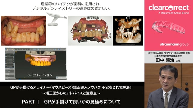 GPが手掛けるアライナー矯正導入ノウハウ 不安をこれで解決