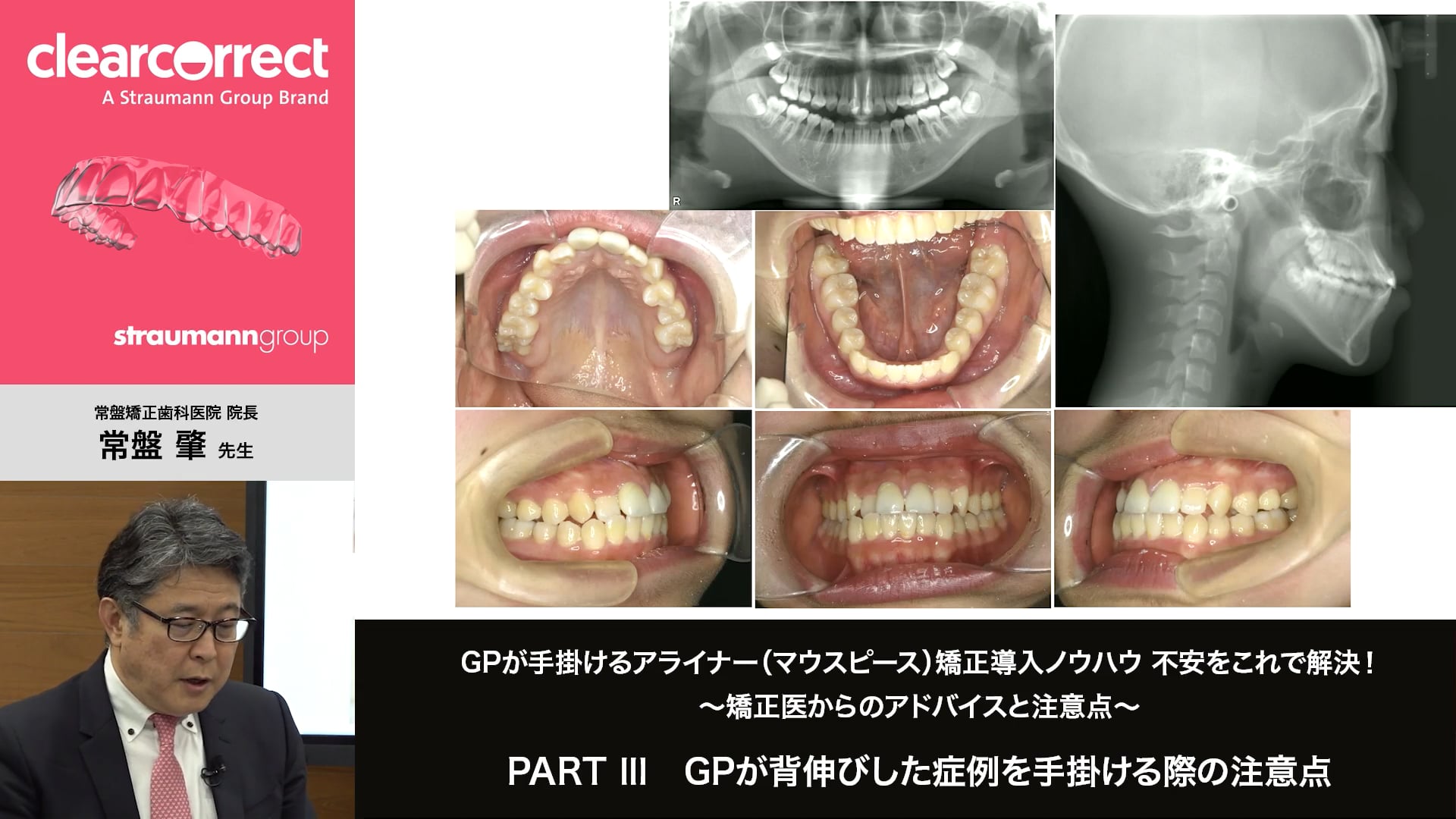 PARTⅢ GPが背伸びした症例を手掛ける際の注意点