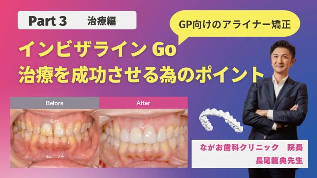 【Part3 治療編】インビザライン Go 治療の大きな可能性！​院内に取り入れるために