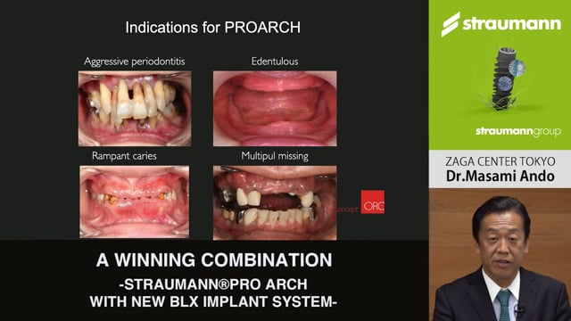 A WINNING COMBINATION -STRAUMANN®PRO ARCH WITH NEW BLX IMPLANT SYSTEM-