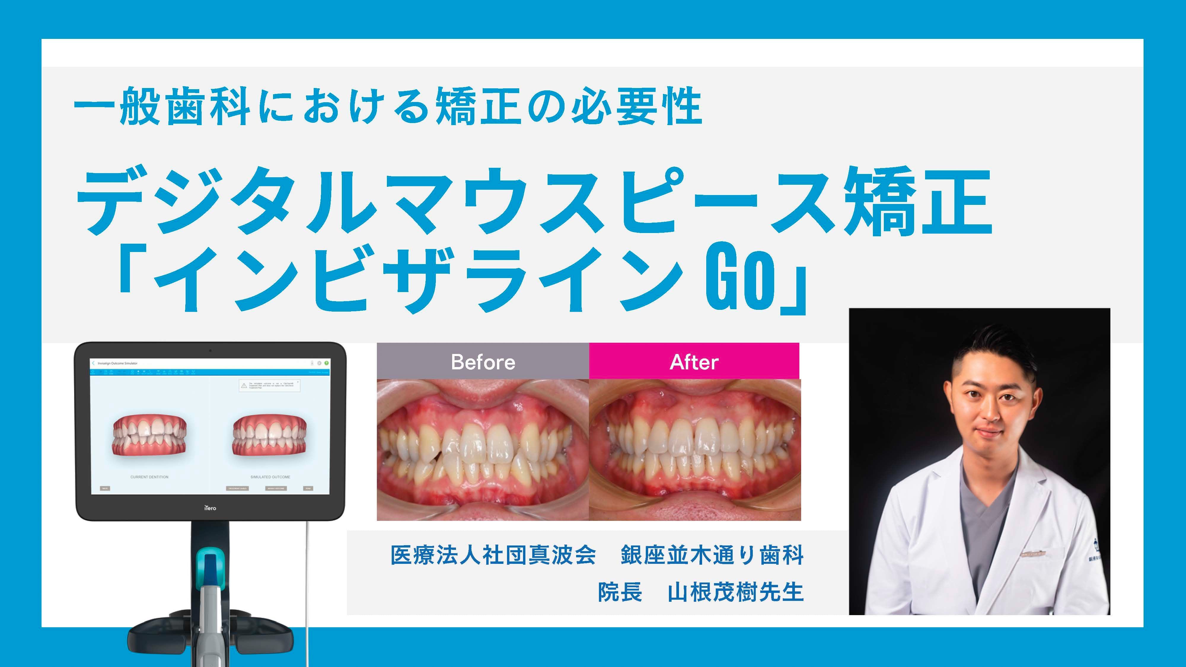 一般歯科における矯正の必要性  デジタルマウスピース矯正 「インビザライン Go」