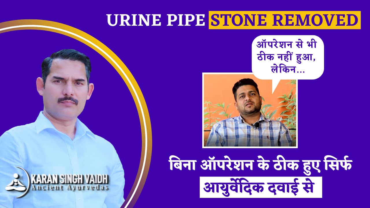 Urine Pipe Stone बिना ऑपरेशन के ठीक हुआ आयुर्वेदिक दवाई से Urine Pipe Stone Treatment on Vimeo