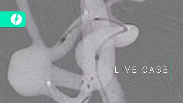 LIVE CASE: Julien Ciagar & Yvana Ledolsse - SLICE Next Frontiers