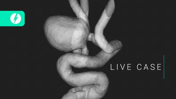 LIVE CASE: Annie Job - SLICE Next Frontiers