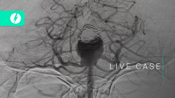 LIVE CASE: Samantha Bidoo - SLICE Next Frontiers