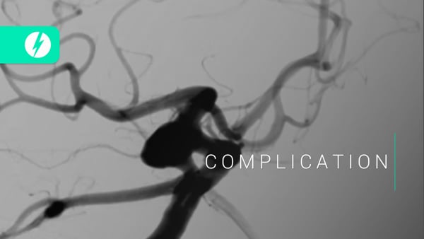 Fish-mouthing of a stent and how to deal with it