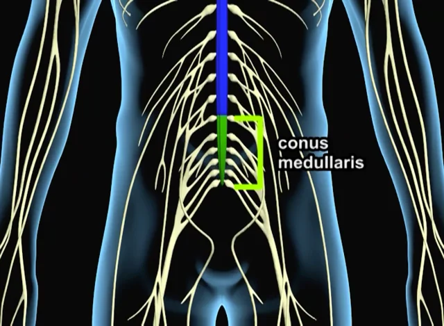 spinal cord cauda equina conus medullaris