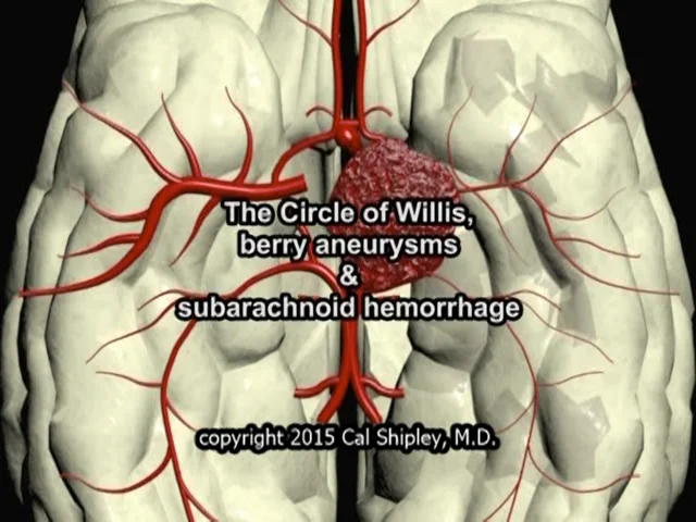 circle of willis brain