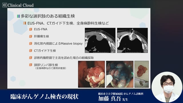 臨床がんゲノム検査の現状　Part2