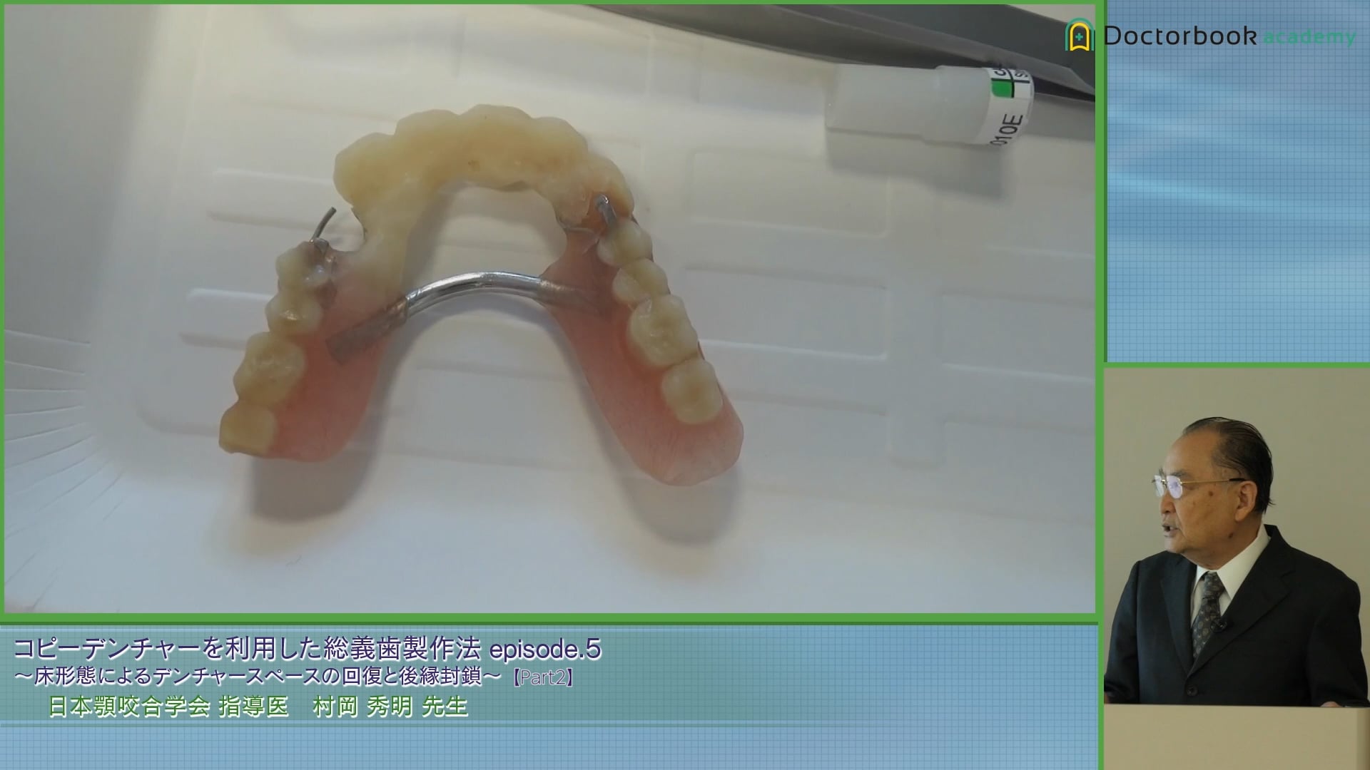 上顎総義歯のコピーデンチャーの作成方法とデンチャースペースの回復 #2