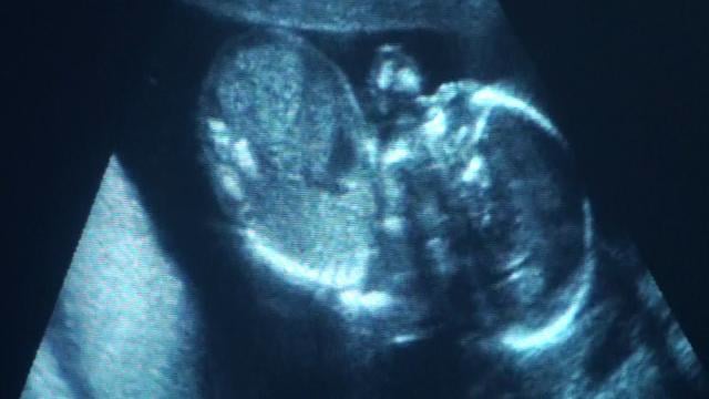 Girly Ultrasound on Vimeo