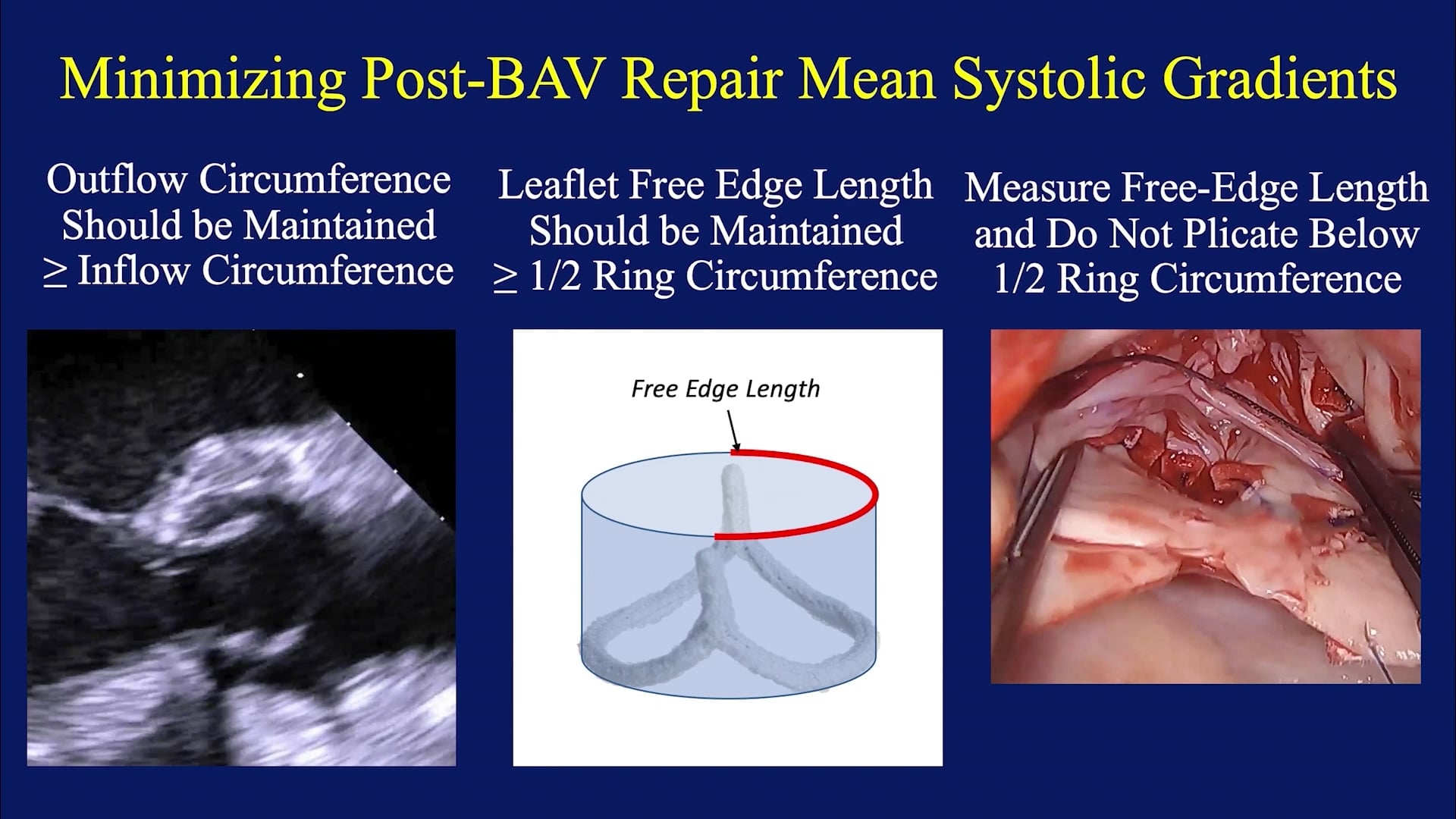 Internal aortic annuloplasty remodeling ring in bicuspid aortic valve ...