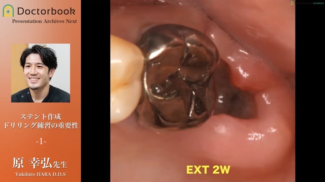 ステント作成 ドリリング練習の重要性 #1